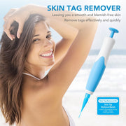 Skin Tag Remover - HOW DO I BUY THIS