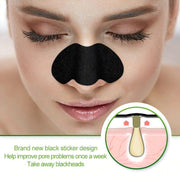 Sticky Nose Patches (100pcs) - HOW DO I BUY THIS